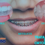 Chica mostrando tipos de brackets de parbo