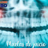 radiografia-panoramica-de-dientes-parbo
