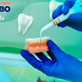 Periodontitis Centro odontológico PARBO